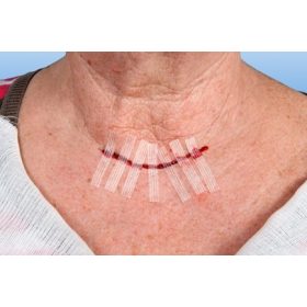 Sebzáró csík RUDASTRIP átlátszó, 38x6mm (6 db/fólia)