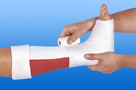 Gipsz alábélelő csőkötszer TRIKOTSCHLAUCHBINDE 15 cm