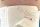 Műtéti haskötő ABDOMINAL BANDAGE körméret 85-95 cm