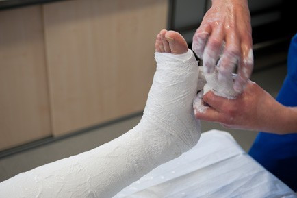 Normál gipszkötés NOBAFORM 10 cm – termékkép