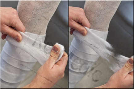 Gipsz alábélelő NOBAPAD Egyenként csomagolva, steril 10 cm
