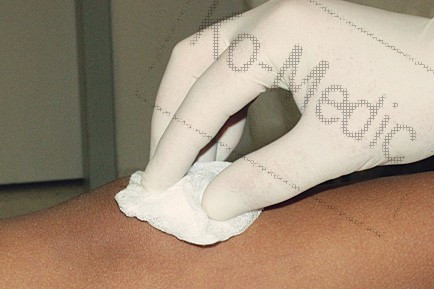 Paprika alakú törlő (steril) 2 rétegű, 5 db paprika/fólia, 10 fólia/dob