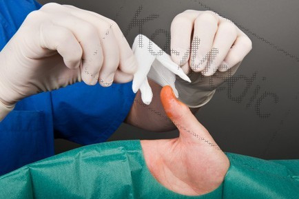 Paprika alakú törlő (steril) 2 rétegű, 5 db paprika/fólia, 10 fólia/dob