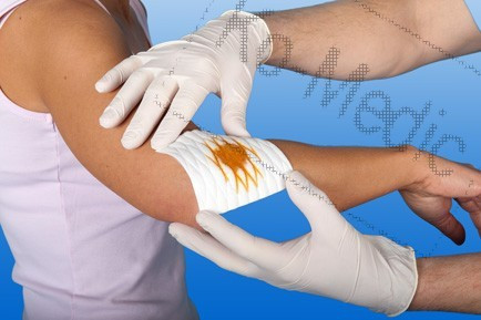 Rollnis sebtörlő NOBAZEM 15 cm