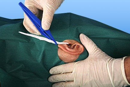 Fültampon GEHÖRGANGTUPFER 8 cm