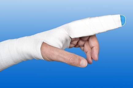 Ujj rögzítő sín, 48 x 2,5 cm