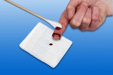 Steril sebkezelő szett NOBASET